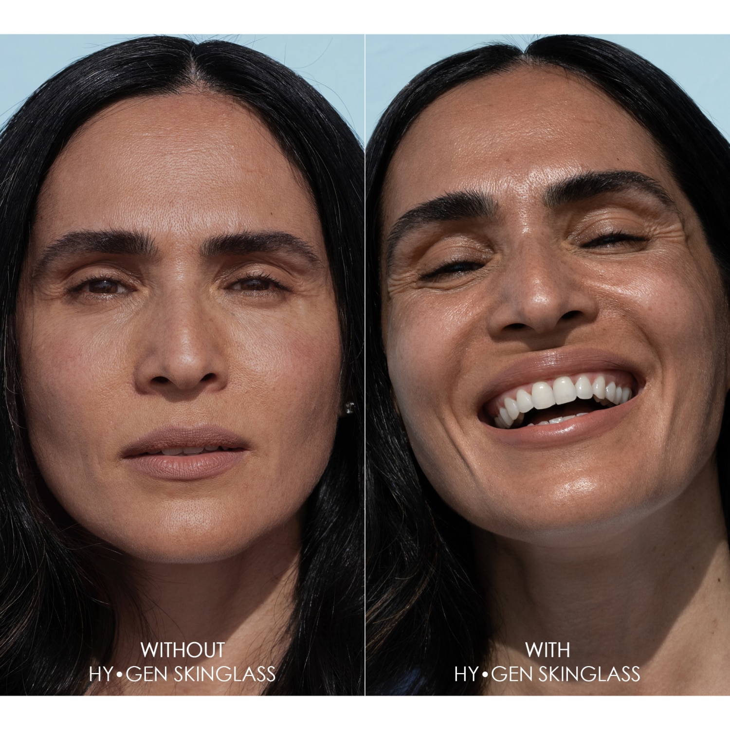 HY-GEN SKIN GLASS (SERUM FACIAL)